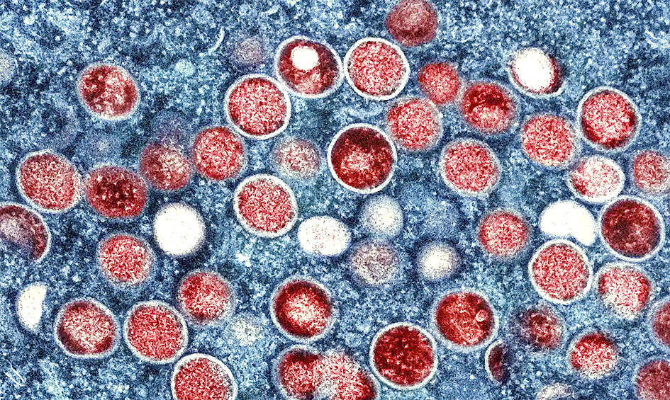 China says not to touch foreigners to avoid monkeypox - Taipei Times