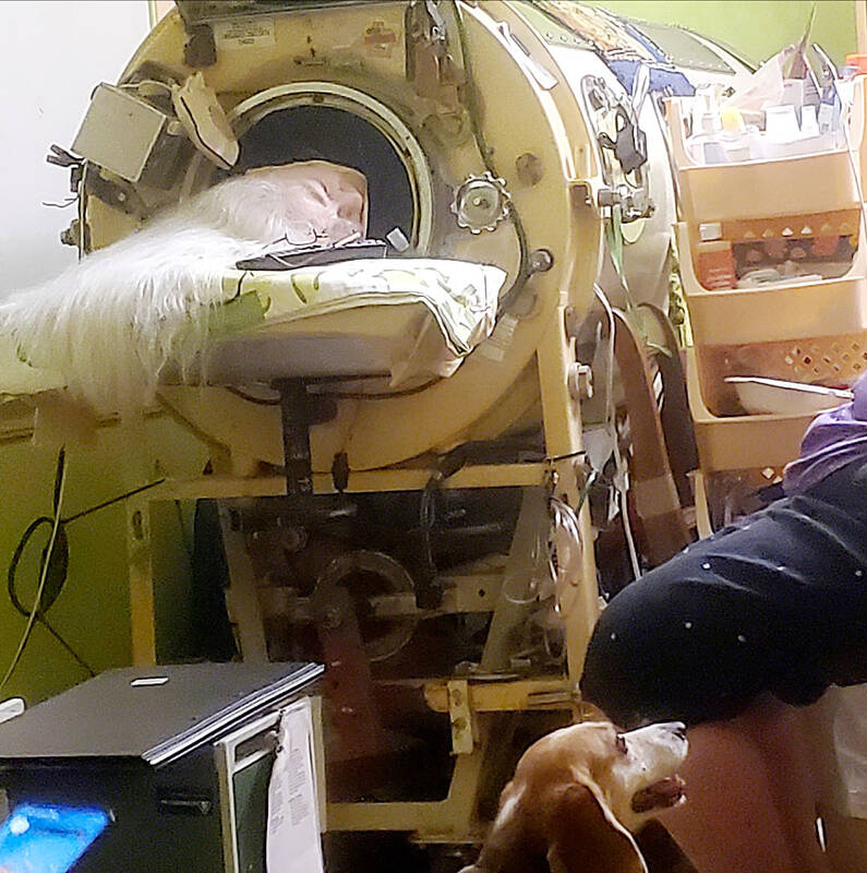 Martha Lillard, the last iron lung user, dies at 78